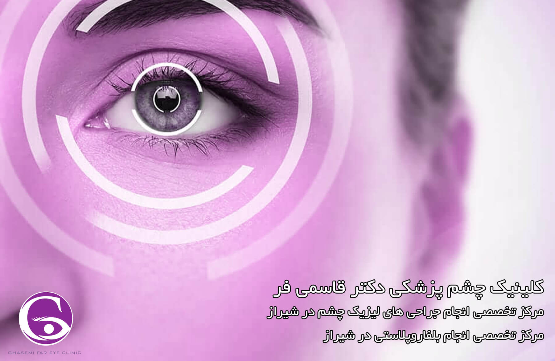 لیزیک چشم در شیراز