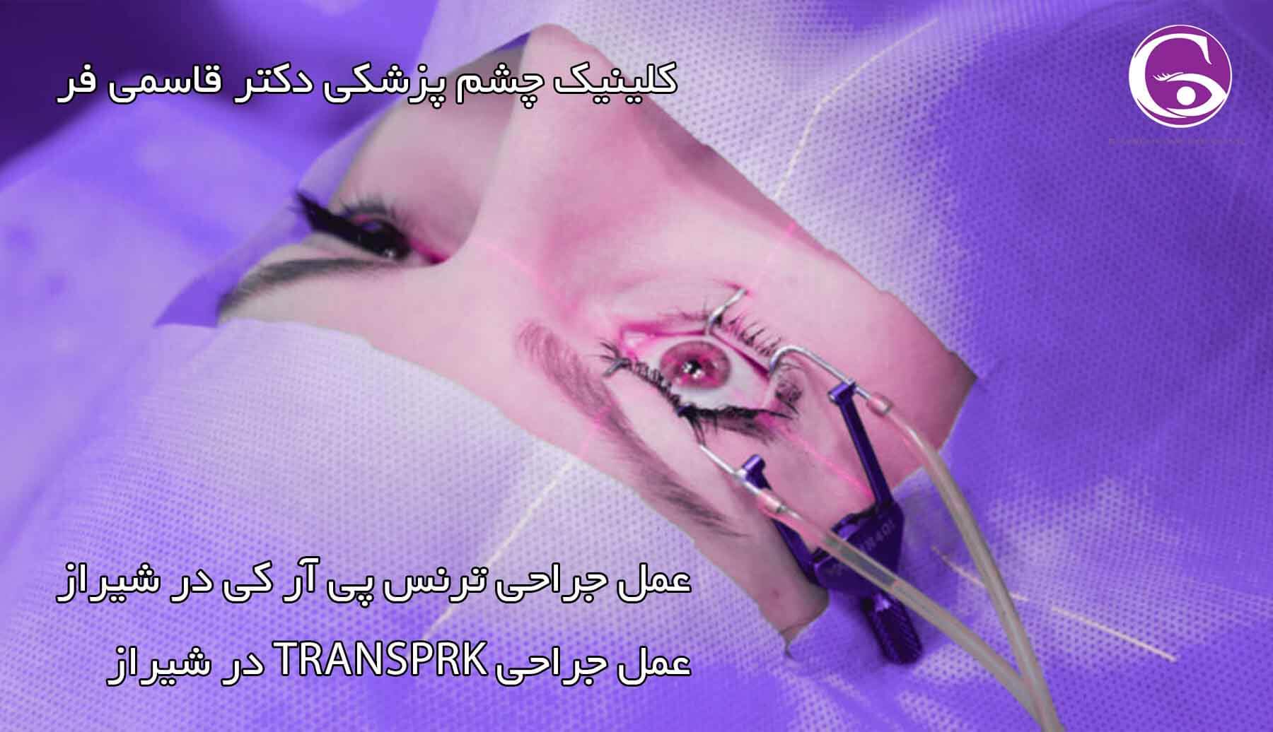 transPRK در شیراز