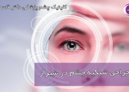جراحی شبکیه چشم در شیراز