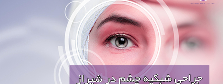 جراحی شبکیه چشم در شیراز