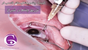 تزریق چشم در شیراز